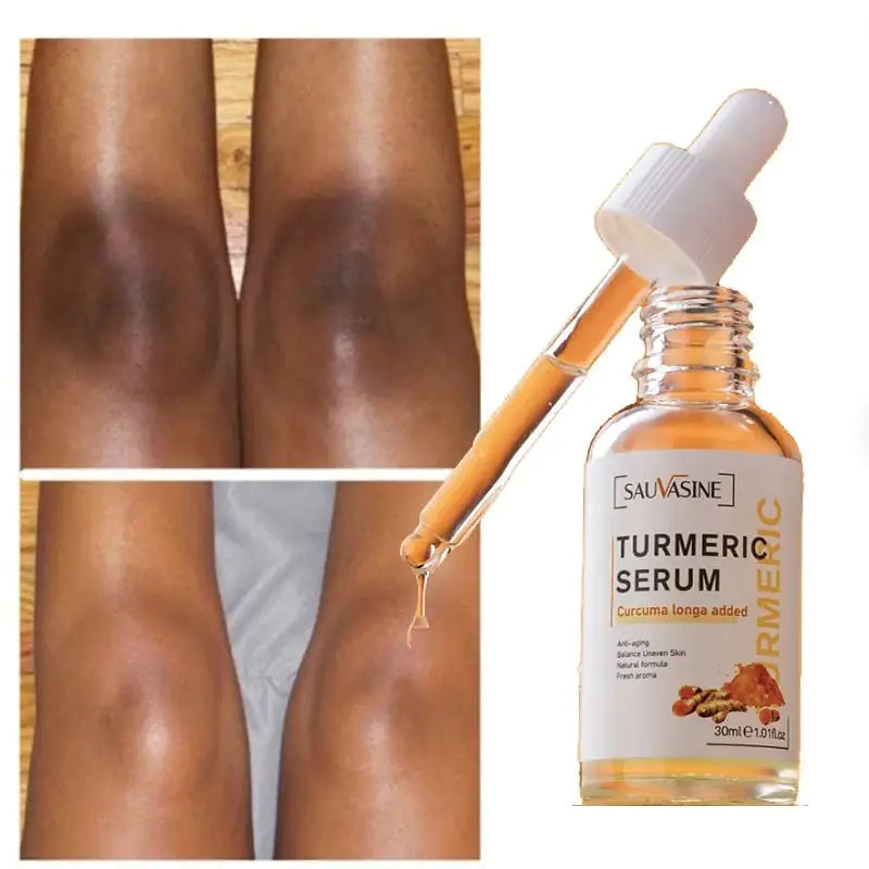 Natural Glow Serum: Turmeric Infused Skincare Solution - DISCOVERIES DEPOT