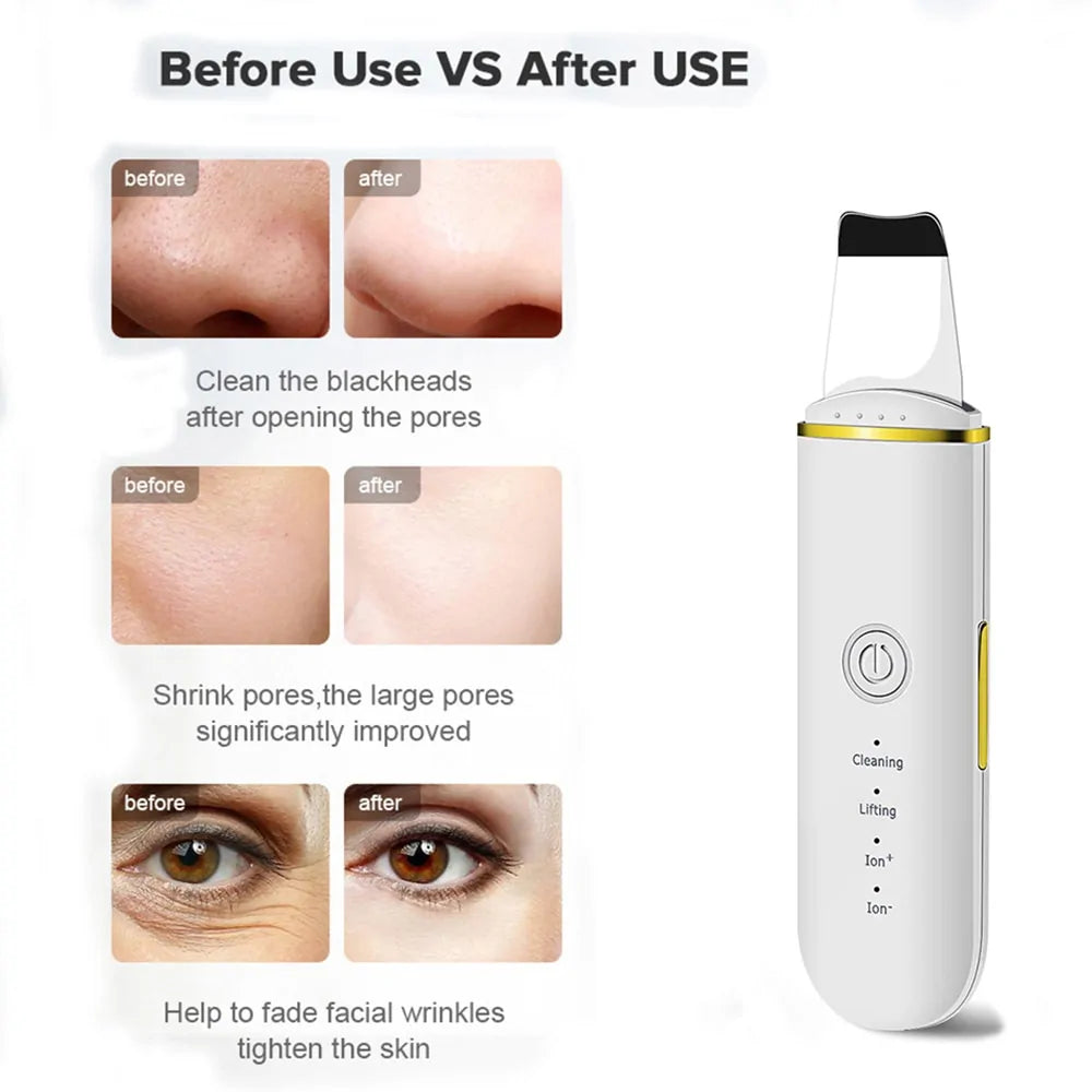 Beauty Ultrasonic Skin Scrubber - DISCOVERIES DEPOT